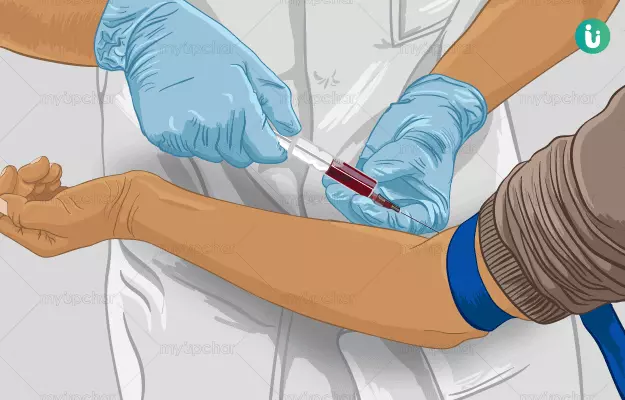 Peripheral Blood Smear Blood Film Pbf Method And Cbc Test Off