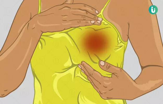 ब्रेस्ट में दर्द क्यों होता है और इलाज - Breast Pain (Mastalgia) in Hindi