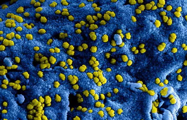 नया कोरोना वायरस गर्मी में भी जीवित रह सकता है, नए शोध में दावा