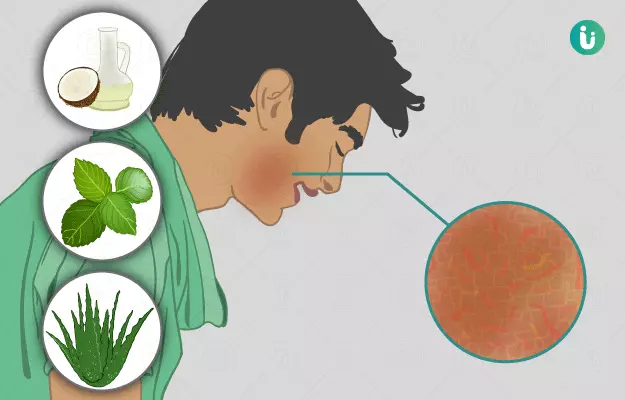 एक्जिमा के घरेलू उपाय - Home Remedies for Eczema in Hindi