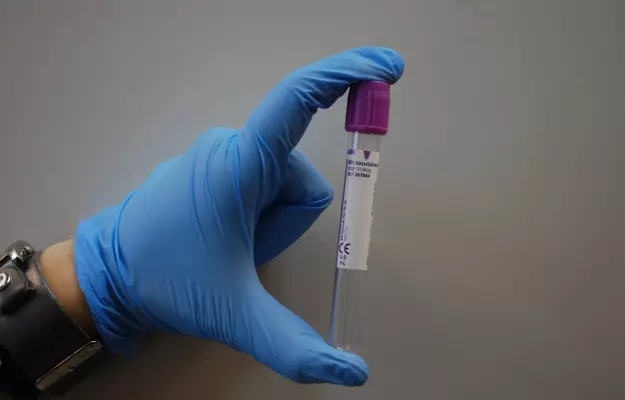 कोविड-19: केवल दस मिनट में कोरोना वायरस का पता लगा सकता है 'नेकेड आई' टेस्ट, जानें इसके बारे में