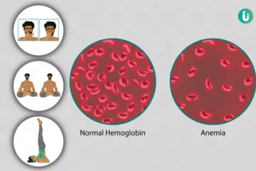 Yoga and Pranayama for Anemia: Boosting Blood Circulation Naturally