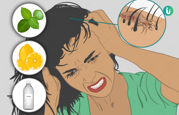Home remedies for head lice: what to use and how to remove head lice