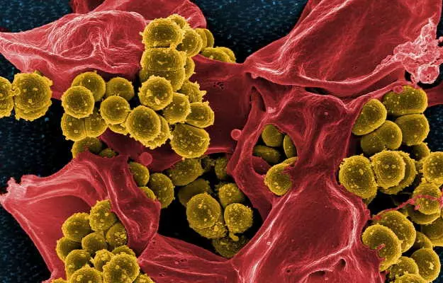 कोविड-19: कोरोना वायरस से बचाने वाले एंटीबॉडी दो-तीन महीने से ज्यादा नहीं टिकते, फिर भी यह चिंता करने वाली बात क्यों नहीं है?