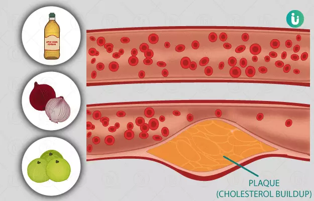 कोलेस्ट्रॉल कम करने के घरेलू उपाय - Home Remedies for High Cholesterol in Hindi