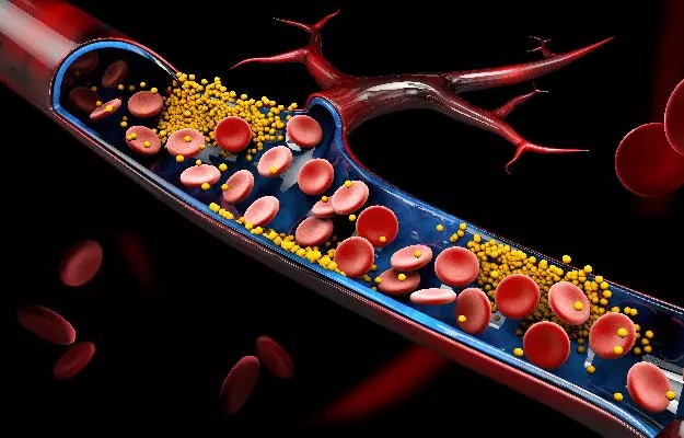 Israel, US researchers find cholesterol drug can help downgrade COVID-19 to common cold