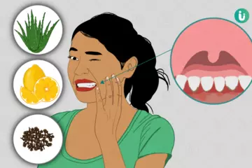 Heal Your Gums: Best DIY Remedies for Gingivitis