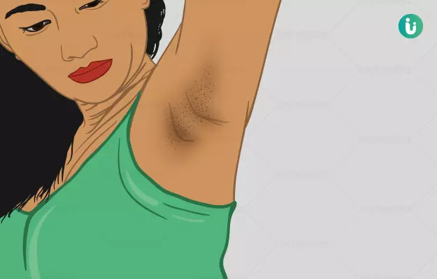बगल का कालापन कैसे दूर करें - Home remedies for dark underarms in Hindi
