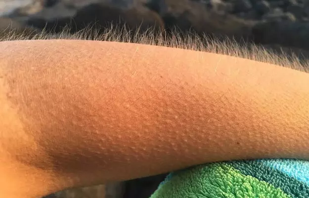 Harvard study solves the mystery of why we get goosebumps