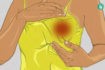 Exploring the Causes of Breast Swelling and How to Treat It