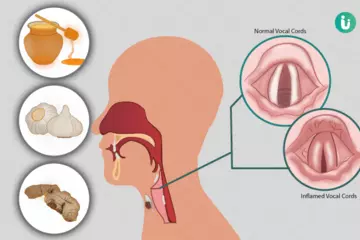 Soothe Your Voice: The Best Home Remedies for Laryngitis