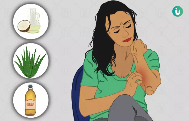 खुजली दूर करने के घरेलू उपाय - Home Remedies for Skin Itching in Hindi