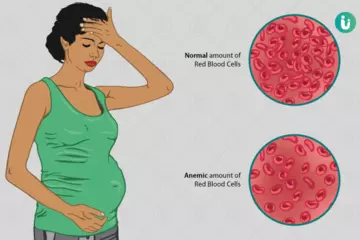 Anemia in Pregnancy: Recognizing Symptoms and Boosting Iron Levels