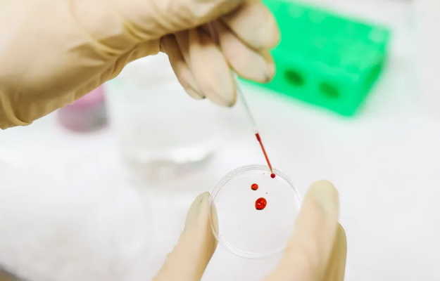 क्या वजह है कि वैज्ञानिक 'फेलूदा' को एंटीजन टेस्ट से बेहतर और आरटी-पीसीआर टेस्ट का विकल्प बता रहे हैं?