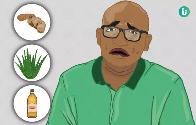 गंजापन दूर करने के घरेलू उपाय - Home Remedies to get rid of Baldness in Hindi