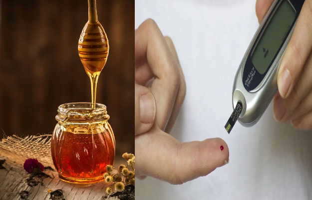 डायबिटीज में शहद खा सकते हैं या नहीं? - Can I eat honey in Diabetes in Hindi