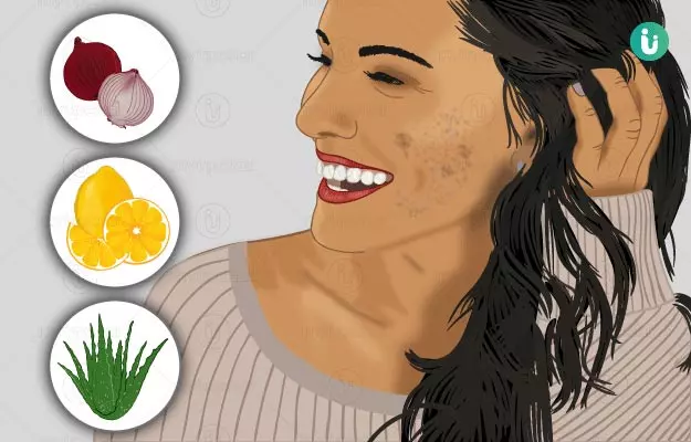 How to remove dark spots on face