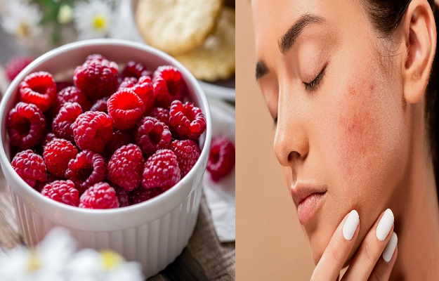 Anti acne diet: Foods to eat and diet plan