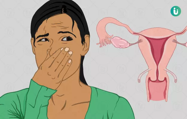 योनि की दुर्गन्ध - Vaginal Odour in Hindi