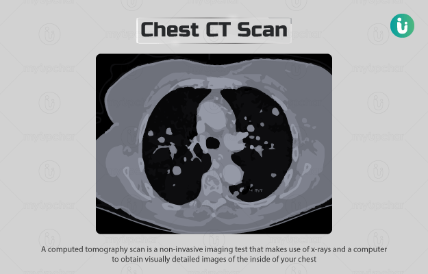 CT Scan: Results, Cost, Price, Online booking