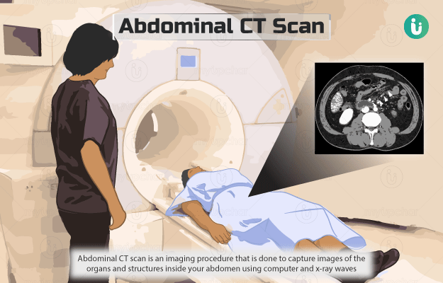 Abdominal CT Scan (whole abdomen)