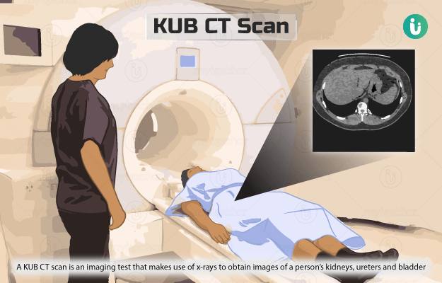 KUB CT scan