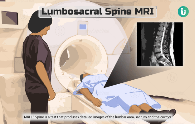 Lumbosacral (LS) spine MRI