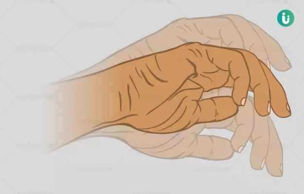 हाथ सुन्न होने का घरेलू उपाय - Home remedies for numbness in hands Hindi