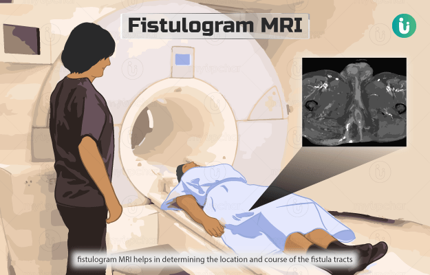 Fistulogram MRI