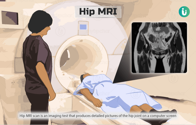 Hip MRI