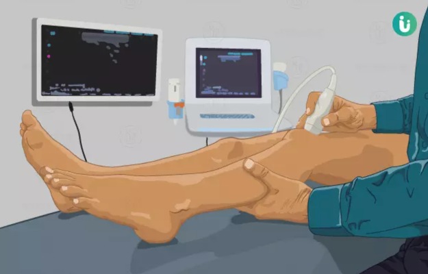 Doppler ultrasound of the arm or leg