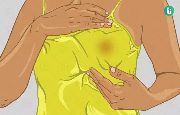 निप्पल में दर्द - Nipple Pain in Hindi