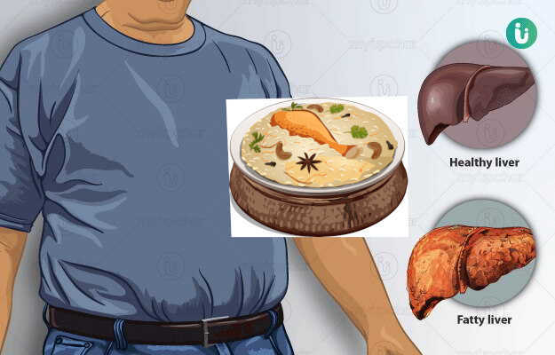 Can We Eat Rice in Fatty Liver?
