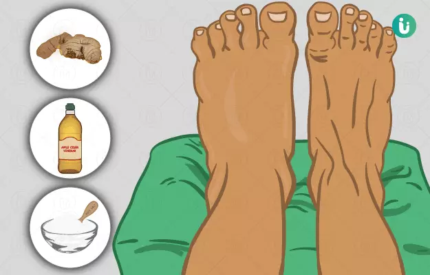 पैरों में सूजन के घरेलू उपाय - Home remedies for swollen feet in Hindi