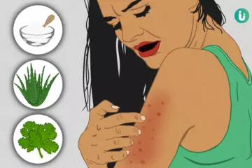 DIY Skin Rash Relief: Simple Home Remedies That Work