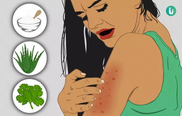 त्वचा पर चकत्तों के घरेलू उपाय - Home Remedies for Skin Rashes in Hindi