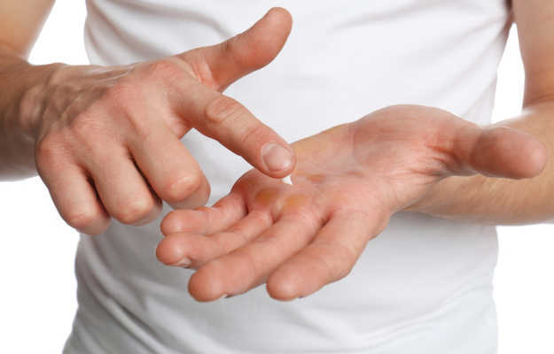 फटे हाथों के घरेलू उपाय - Home remedies for cracked hands in Hindi