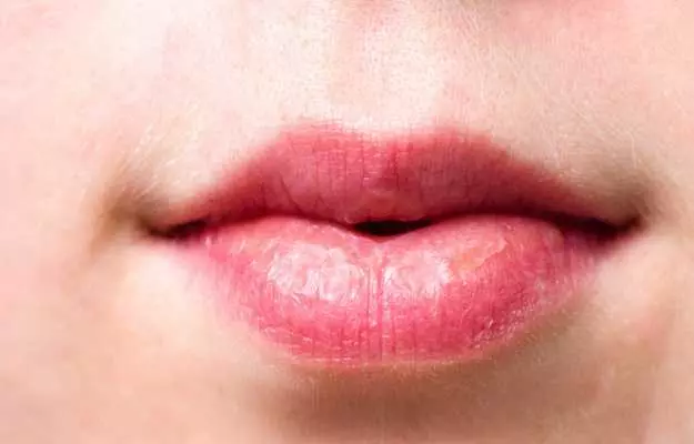 होठों का कालापन दूर करने और गुलाबी बनाने के उपाय - How to make black lips pink in Hindi