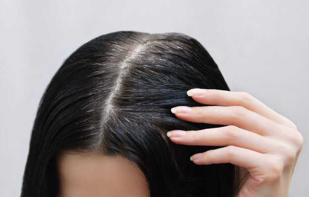 बालों को सफेद होने से कैसे रोकें? - How to stop hair from turning grey in Hindi