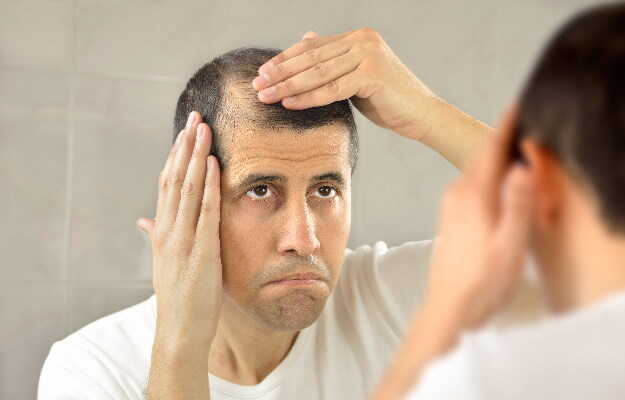पुरुषों के बाल क्यों झड़ते हैं - Hair loss causes in men in Hindi