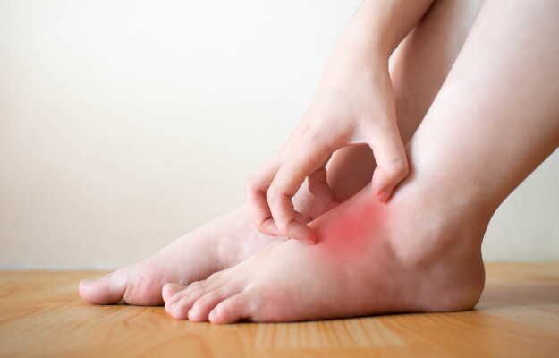 Natural Relief for Burning Feet: Ayurvedic Medicine For Burning Feet