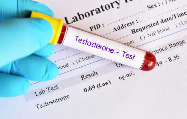 टेस्टोस्टेरोन ज्यादा होने के नुकसान - Side effects of high testosterone in Hindi