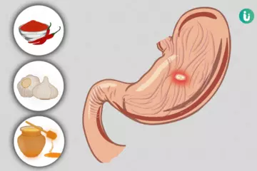 Gentle and Natural: Best Home Remedies for Stomach Ulcers