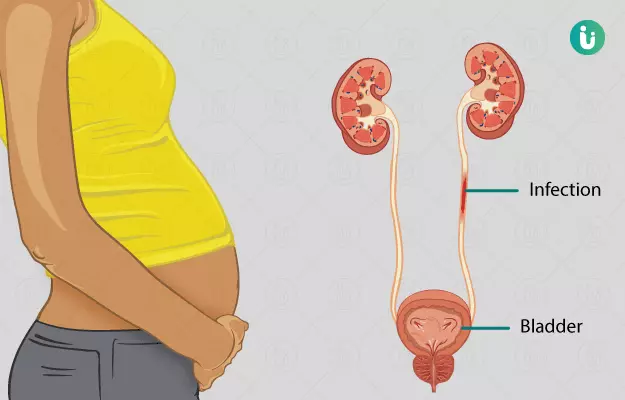 प्रेग्नेंसी में यूरिन इन्फेक्शन - Urine infection during pregnancy in Hindi