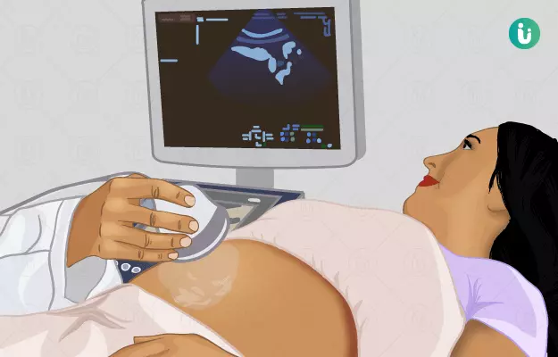 గర్భధారణ సమయంలో అల్ట్రాసౌండ్: ఎందుకు, ఎప్పుడు మరియు ఎలా  దానిని నిర్వహించాలి? - Ultrasound during pregnancy: why, when and how it is done?