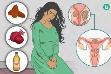 How to Manage Ovarian Cysts Naturally with Simple Home Remedies