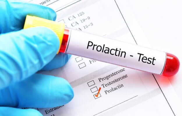 Understanding Prolactin: Normal Ranges, Symptoms, Causes, and Treatment