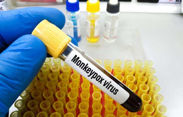 मंकीपॉक्स से बचाव का तरीका - How to prevent monkeypox infection in Hindi