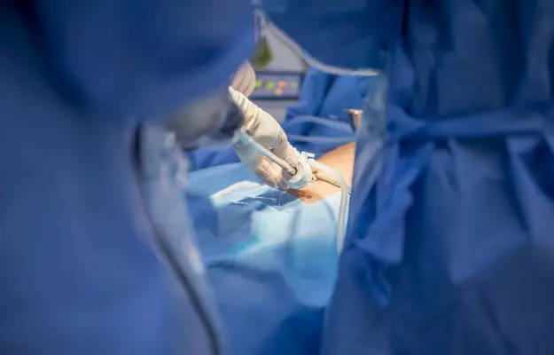 सिस्टेक्टोमी - Bladder removal surgery (cystectomy) in Hindi