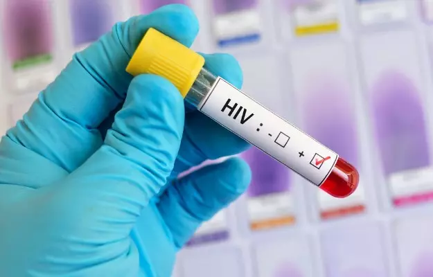 एचआईवी पॉजिटिव मरीज सुरक्षित सेक्स कैसे करें? - How HIV positive patients can have safe sex in Hindi